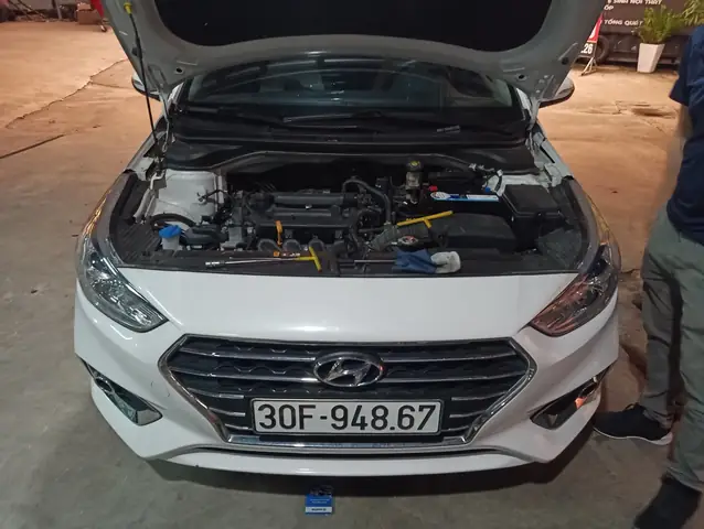 Một Số Lưu Ý Trước Khi Thay Ắc Quy Cho Hyundai Accent