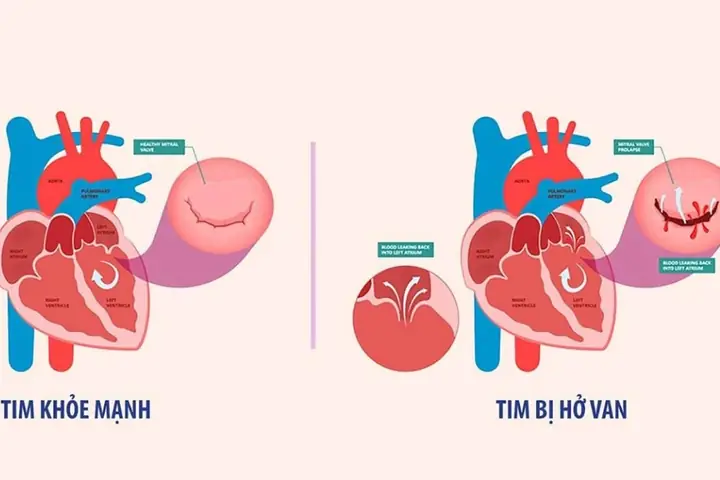 Lái Xe Các Hạng A2, A3, A4, B2, C, D, E, Fb2, Fc, Fd, Fe: