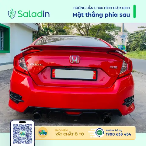 2.1. Mặt Thẳng Phía Trước Và Mặt Thẳng Phía Sau