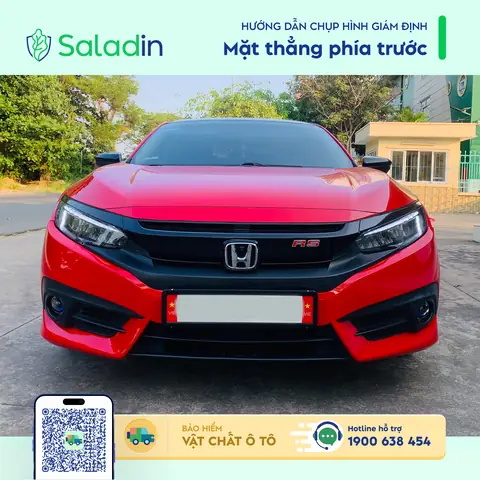 2.1. Mặt Thẳng Phía Trước Và Mặt Thẳng Phía Sau