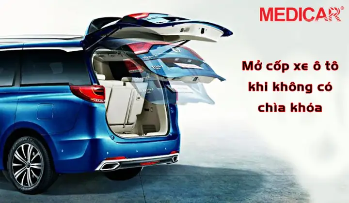 Cach Mo Cop Xe O To Khi Quen Chia Khoa