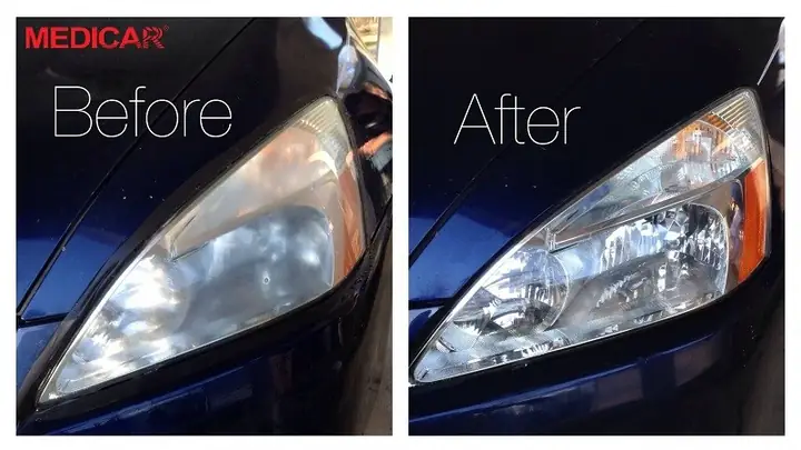 Đánh Bóng Đèn Xe Ô Tô Là Gì?