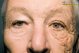 Những Ảnh Hưởng Khi Phải Lái Xe Dưới Trời Nắng Nóng