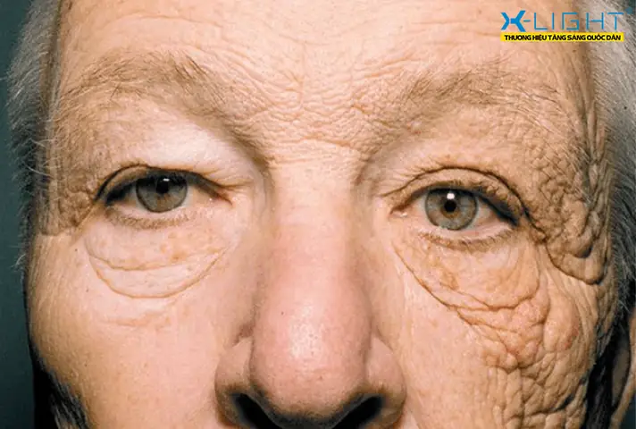 Những Ảnh Hưởng Khi Phải Lái Xe Dưới Trời Nắng Nóng