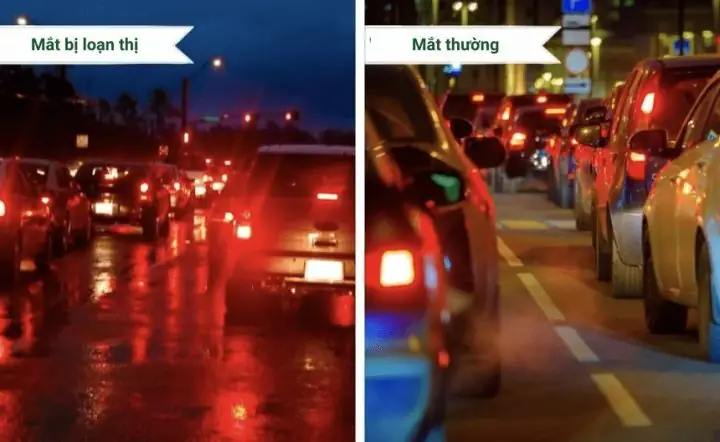 Loạn Thị Có Lái Xe Ô Tô Được Không? Giải Đáp Chi Tiết