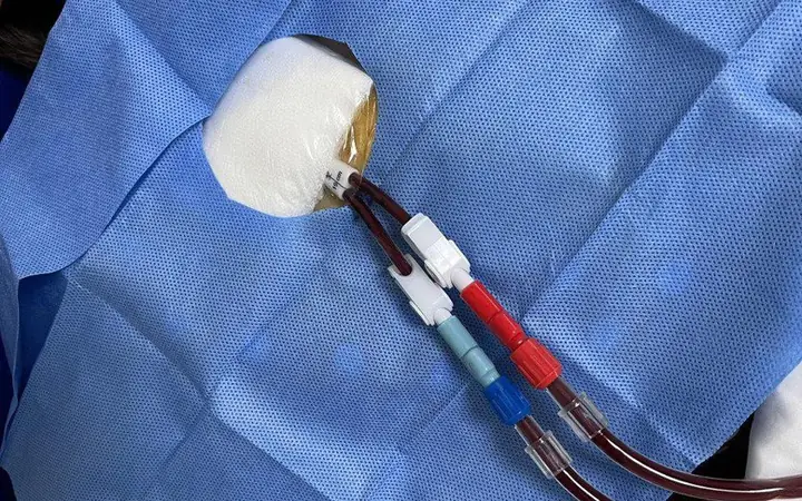 Đề Xuất Sửa Điều Kiện Thanh Toán Dịch Vụ Kỹ Thuật Y Tế Thuộc Phạm Vi Được Hưởng Bảo Hiểm Y Tế