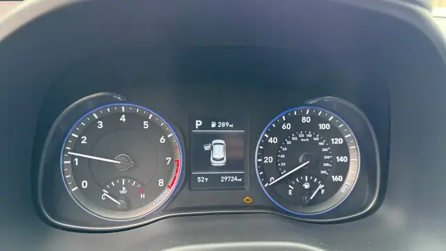 Xe Ô Tô Bị Gằn Máy: Nguyên Nhân, Dấu Hiệu Nhận Biết Và Cách Khắc Phục Hiệu Quả