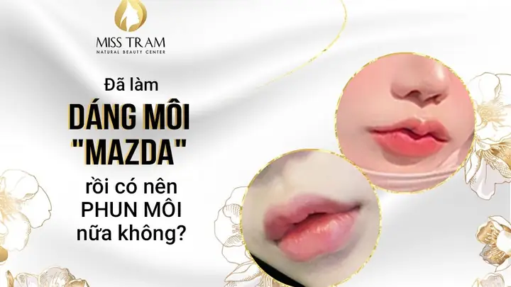 Top 5 Dòng Xe Mazda Có Thiết Kế 'mồm' Đẹp Nhất 2026