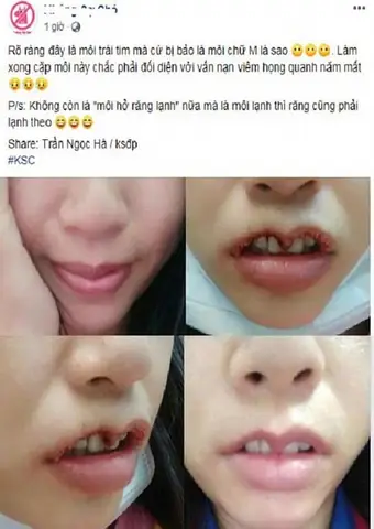 Mazda Dáng Mui Cứng: Đặc Điểm, Lợi Ích Và Ảnh Hưởng Trải Nghiệm Lái